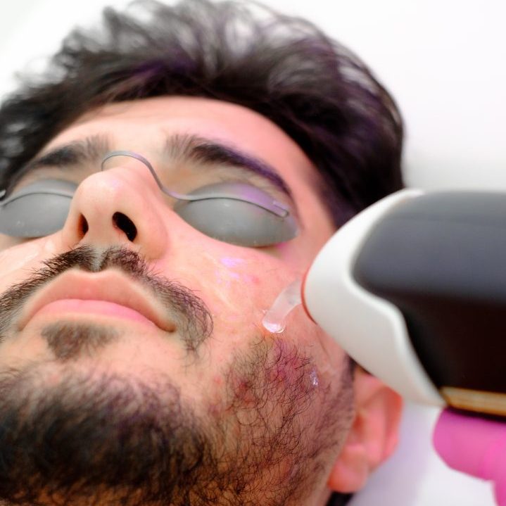 Men Laser Services - Image 2